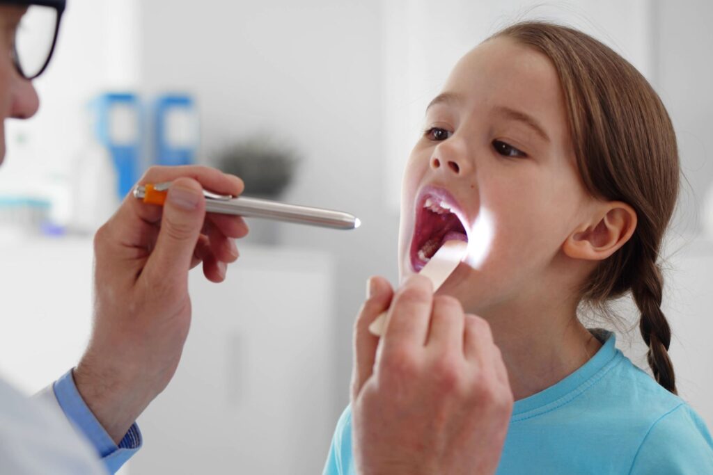 Medico verifica la presenza di candidosi orale in una bambina