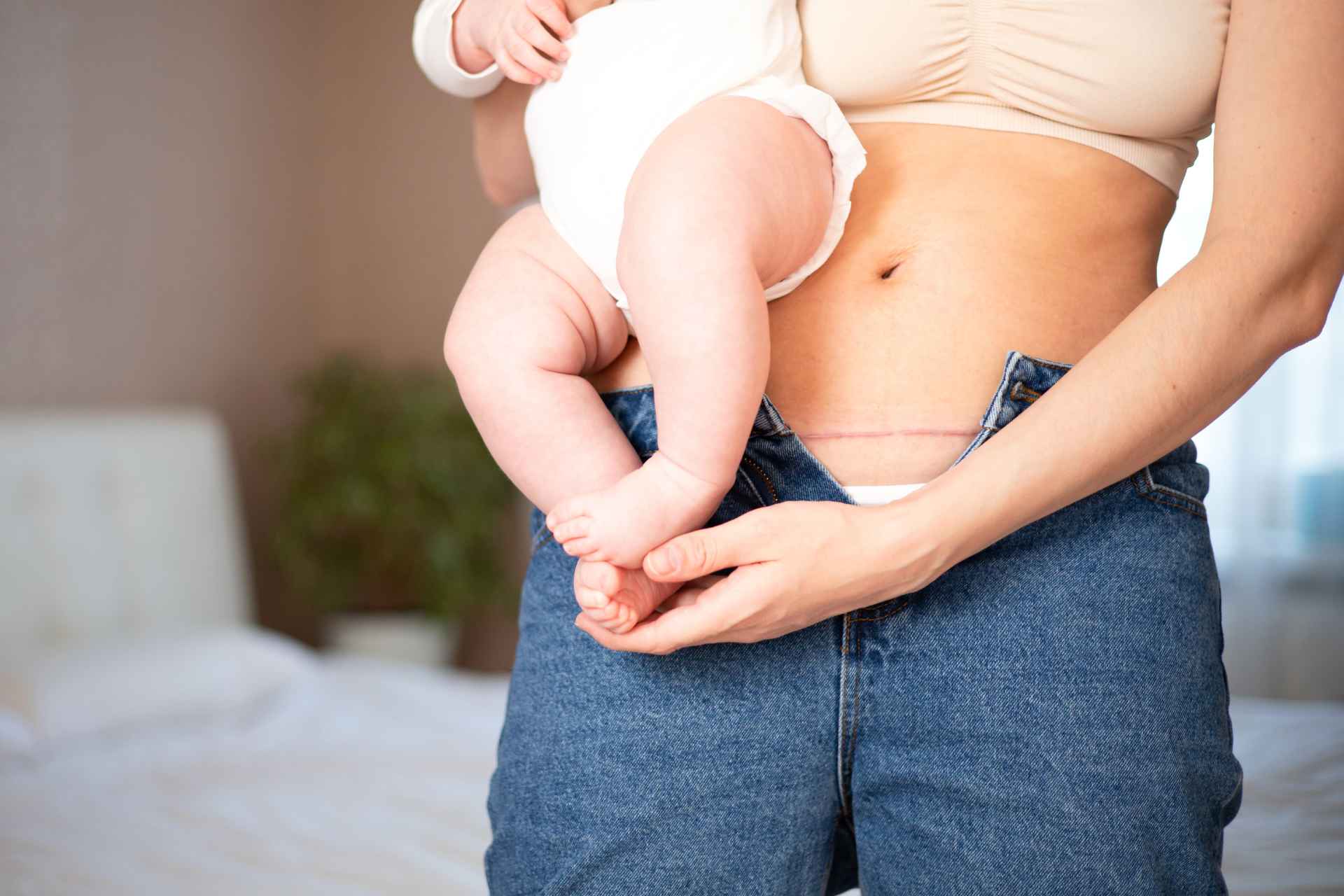 Il parto cesareo altera il microbiota intestinale e il sistema immunitario dei neonati