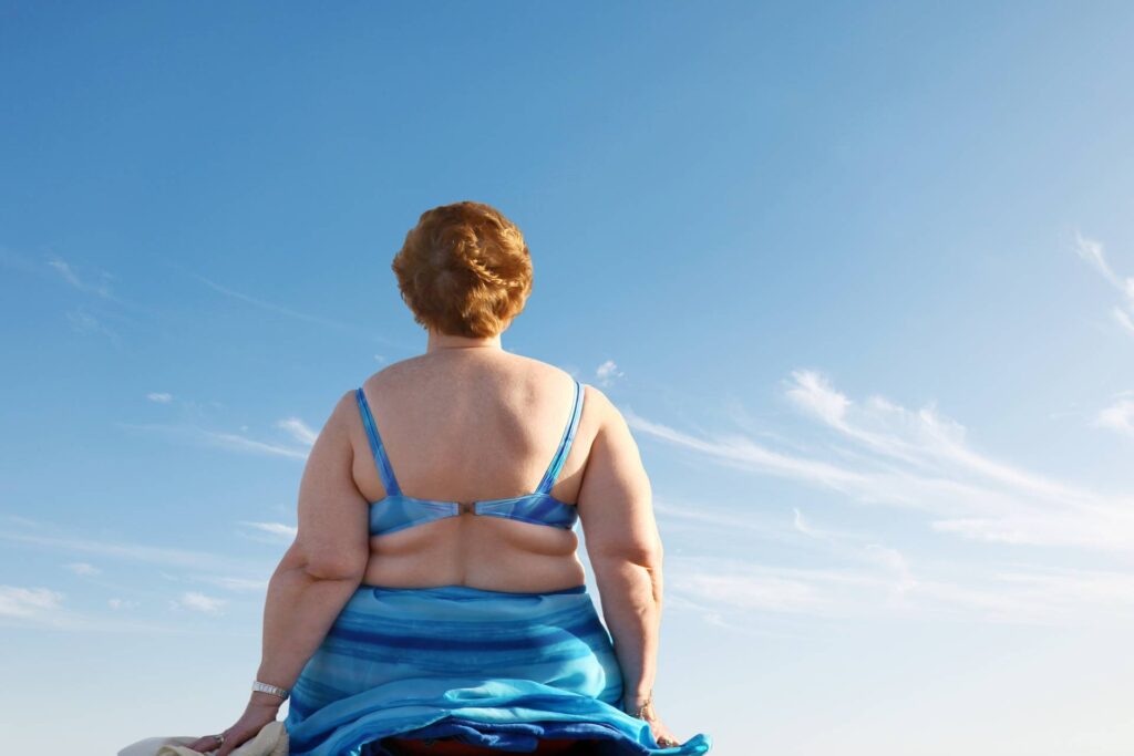 donna in sovrappeso di spalle prende il sole al mare in costume